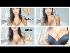 Upbra before and after