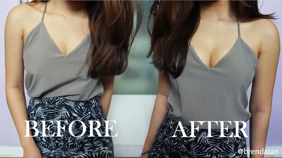 Upbra Cleavage Bra - Before & After